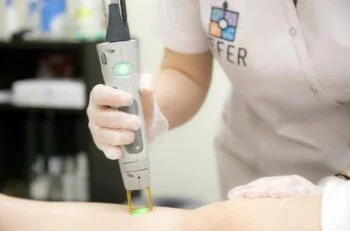 رفع موهای زائد با لیزر الکساندرایت